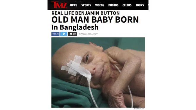 Un Vieux Bebe Vient De Naitre Au Bangladesh Il A Les Traits D Un Homme De 80 Ans Rtl People