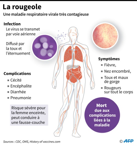  Measles: third death in 2018 in France, a 17-year-old girl in Bordeaux "title =" Measles: third death in 2018 in France, a 17-year-old girl in Bordeaux "/>


<p> MeaslesN. Shearman / J. Saeki </p>
</p></div>
<div id=