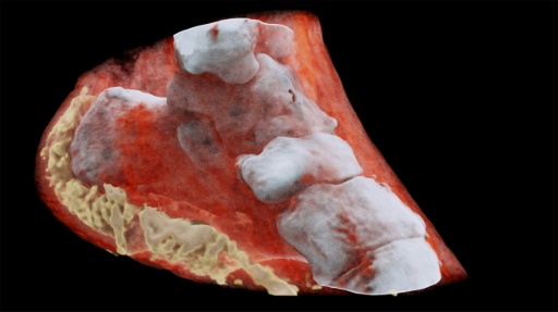  First 3D color radiography of a human "title =" First 3D color radiography of a human "/>


<p> Three-dimensional (3D) color X-ray of ankletHO </p>
</p></div>
<div id=
