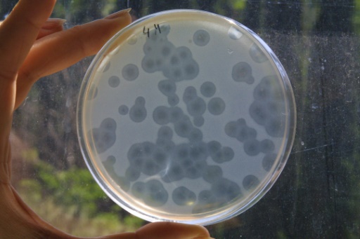 Multidrug-resistant bacteria responsible for 33,000 deaths in Europe