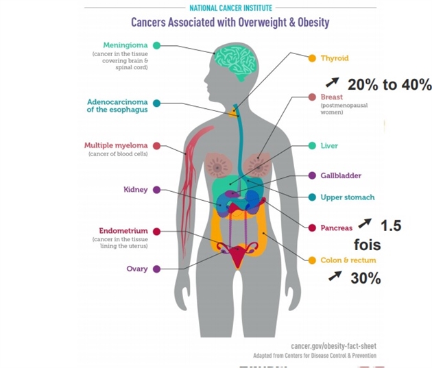 L Obesite Est La 2e Cause De Cancer Apres Le Tabac Comment Les Cellules De La Masse Grasse Interagissent Elles Avec Les Tumeurs Rtl Info