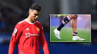 Deux trous et des bleus- les jambes de Cristiano Ronaldo sont dans un sale état après la défaite de son équipe (photos)