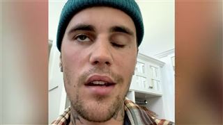 Justin Bieber paralysé de la moitié du visage- sa femme Hailey Bieber donne de ses nouvelles (vidéo)