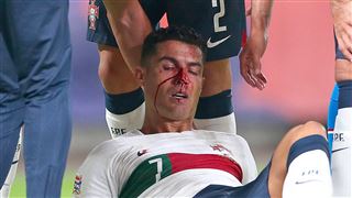 Nez en sang, penalty offert à l'adversaire- la soirée cauchemardesque de Cristiano Ronaldo (photos)